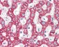 MCAD / ACADM Antibody (C-Terminus)